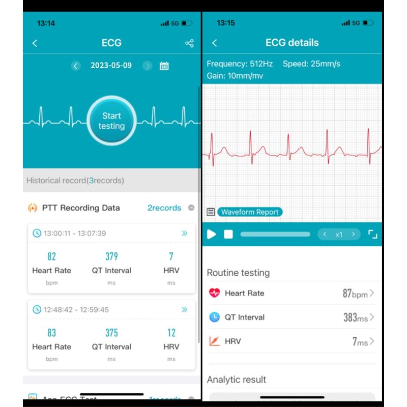 ET540 Smartwatch: ECG, Bloedglucose & Temperatuur! Fitness Tracker met Bloeddruk, Hartslag & Bluetooth Bellen