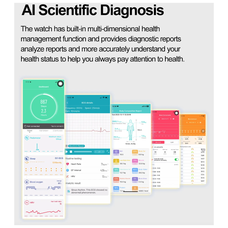 E580 Bloedglucose Smartwatch: ECG, Hartslag, Bloeddruk, IP68. Jouw Gezondheidsbewaker & Welzijn!