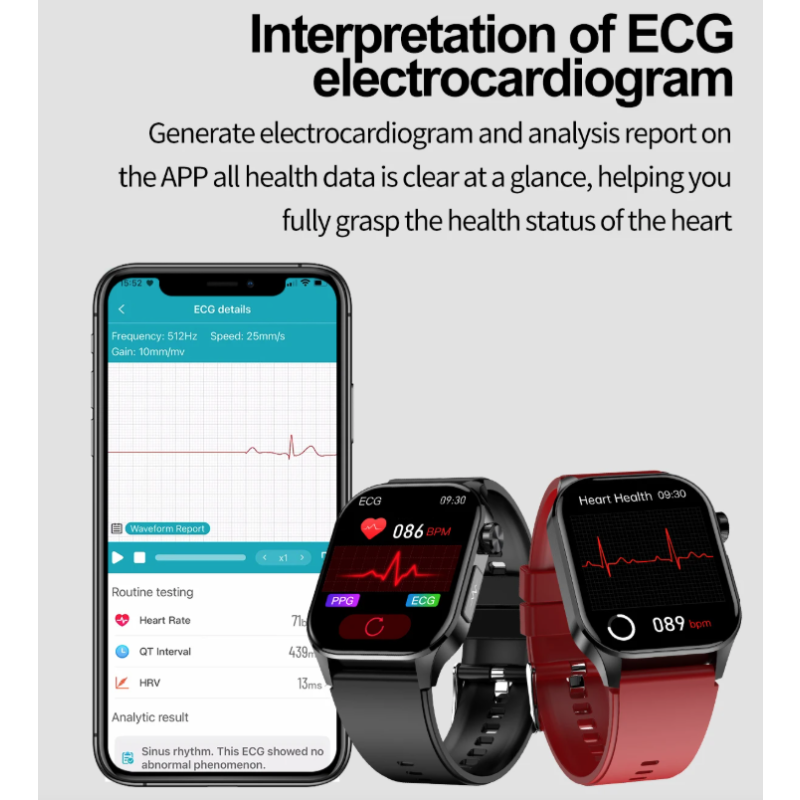 E580 Bloedglucose Smartwatch: ECG, Hartslag, Bloeddruk, IP68. Jouw Gezondheidsbewaker & Welzijn!