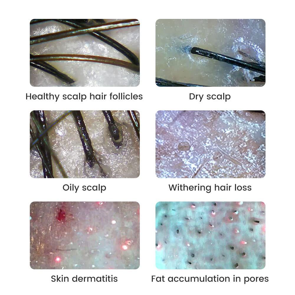 Digitale microscoop 500x vergroting 2MP loep elektronica reparatie video munten microscoop handheld dermatoscoop huidanalysemachine