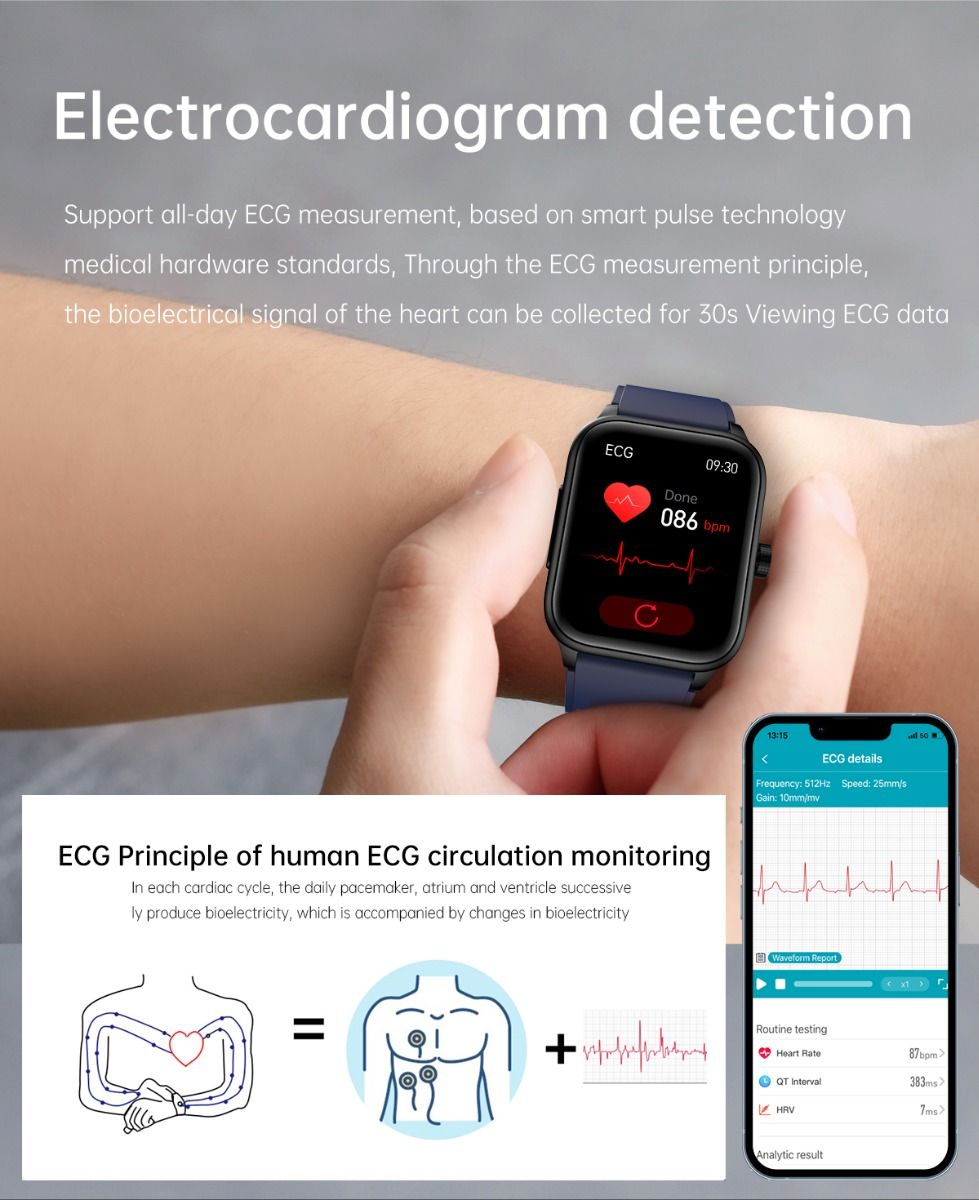 ET540 Smartwatch: ECG, Bloedglucose & Temperatuur! Fitness Tracker met Bloeddruk, Hartslag & Bluetooth Bellen