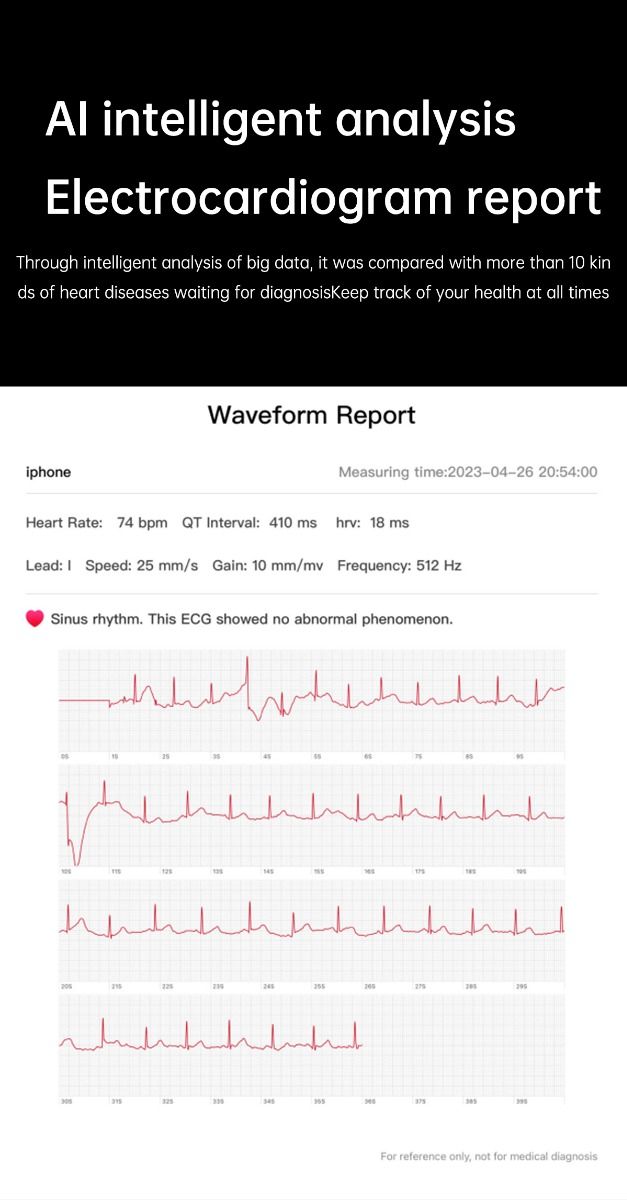 ET540 Smartwatch: ECG, Bloedglucose & Temperatuur! Fitness Tracker met Bloeddruk, Hartslag & Bluetooth Bellen