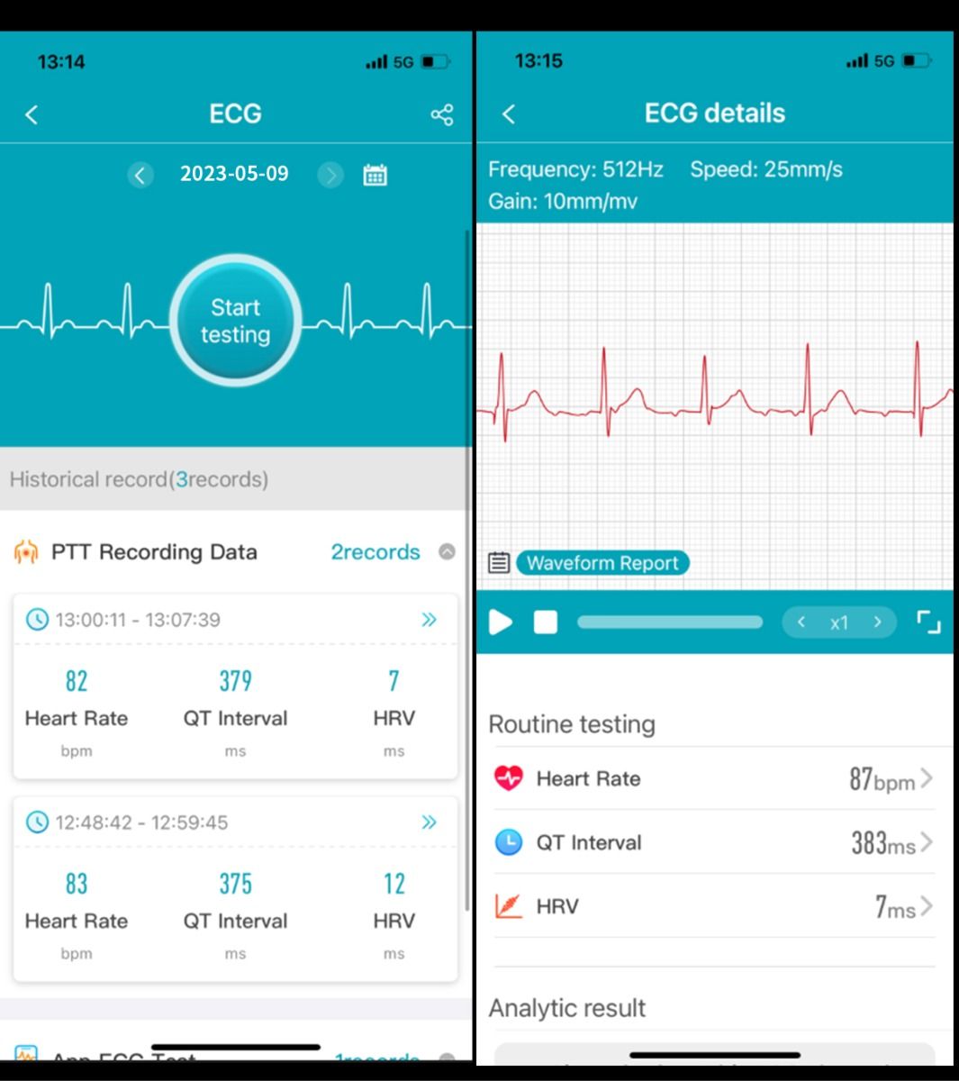 ET540 Smartwatch: ECG, Bloedglucose & Temperatuur! Fitness Tracker met Bloeddruk, Hartslag & Bluetooth Bellen