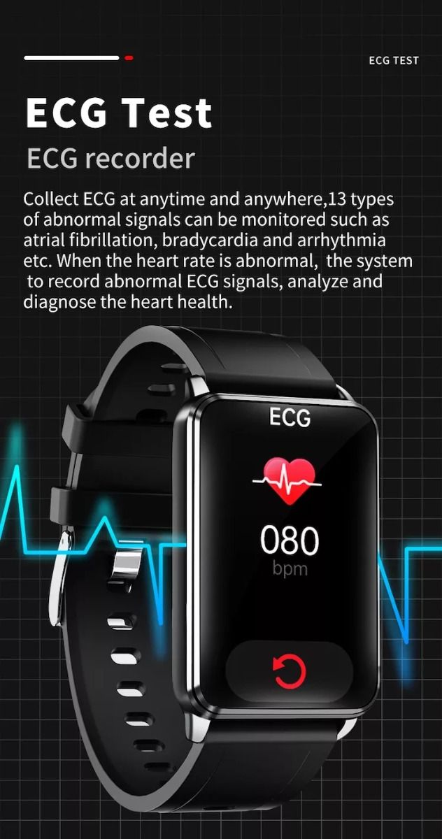 EP02 Bloedglucose Smartwatch ECG HRV hartslag temperatuur 1.57-inch HD waterdichte Smart Armband Fitness Tracker