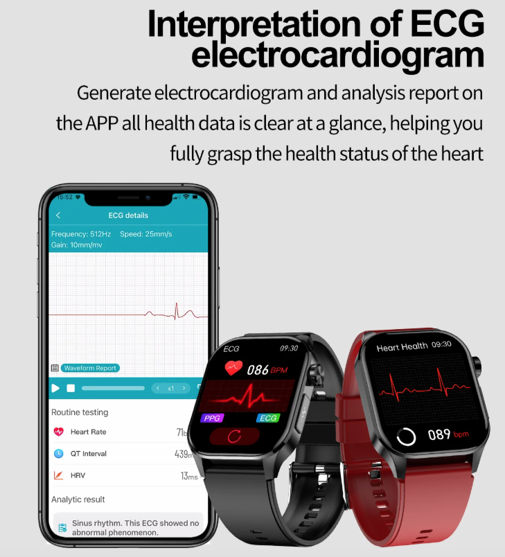 E580 Bloedglucose Smartwatch: ECG, Hartslag, Bloeddruk, IP68. Jouw Gezondheidsbewaker & Welzijn!